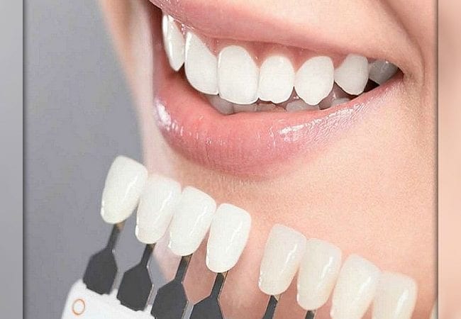 Протезирование и отбеливание зубов с высоким качеством услуг