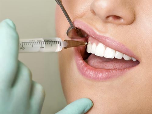 Лечение зубов в клинике Москвы