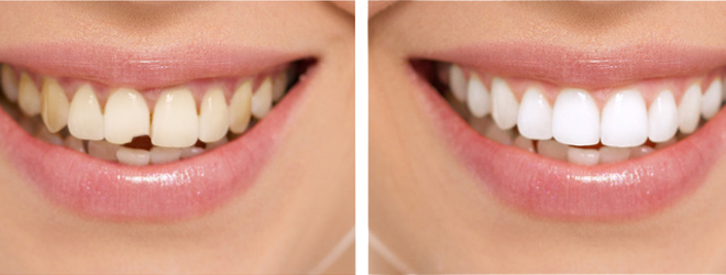 Эстетическая стоматология призвана вернуть не только здоровье зубов
