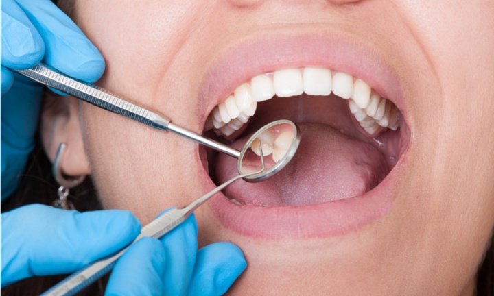 Лечение зубов: на что обратить внимание