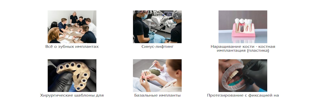 Как мозг привыкает к новому зубу: нейрофизиология после имплантации